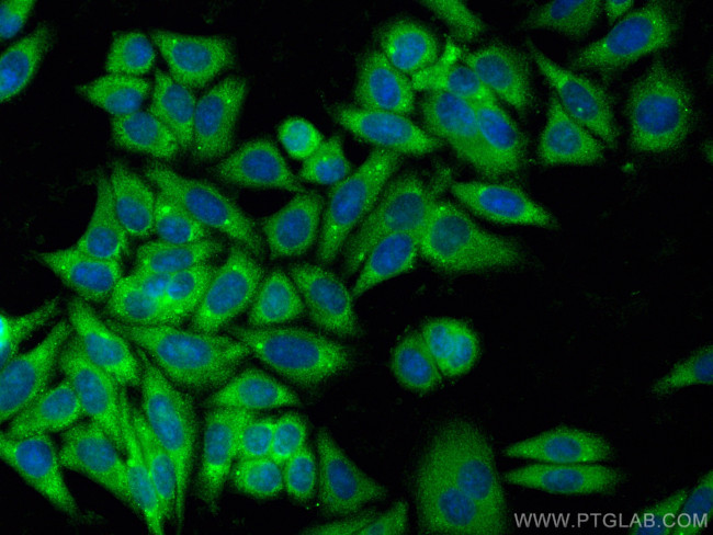 GIPC1 Antibody in Immunocytochemistry (ICC/IF)