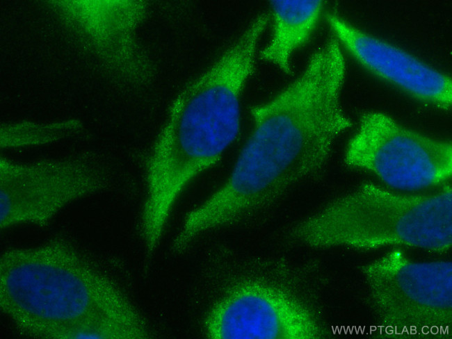 RPS27A Antibody in Immunocytochemistry (ICC/IF)