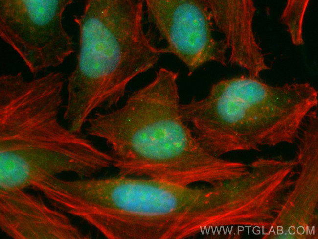 SNIP1 Antibody in Immunocytochemistry (ICC/IF)