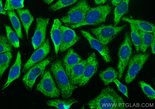 PABPC4 Antibody in Immunocytochemistry (ICC/IF)
