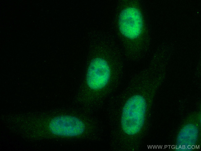 SKP2 Antibody in Immunocytochemistry (ICC/IF)