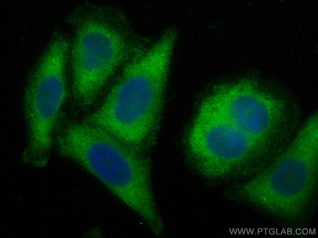 AZI2/NAP1 Antibody in Immunocytochemistry (ICC/IF)