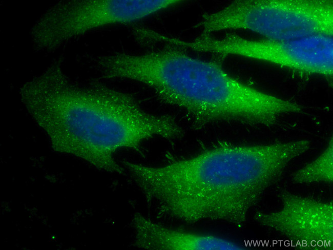 ARPC2 Antibody in Immunocytochemistry (ICC/IF)