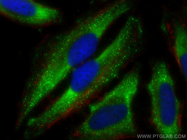 HPRT1 Antibody in Immunocytochemistry (ICC/IF)