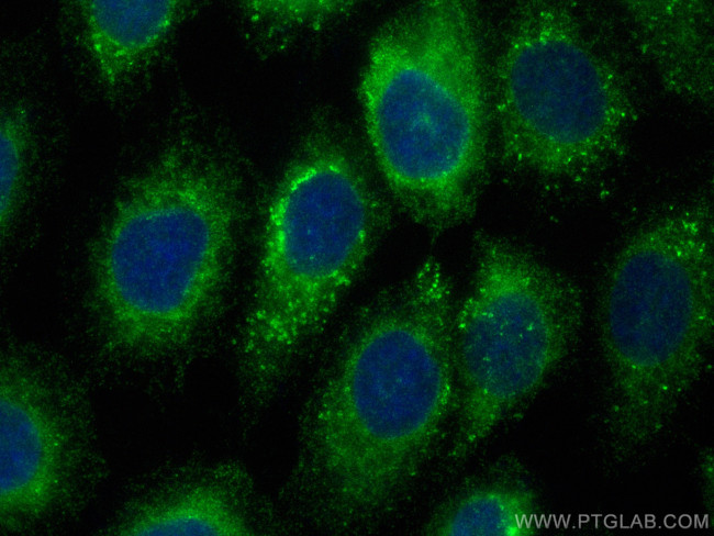 LPCAT2 Antibody in Immunocytochemistry (ICC/IF)