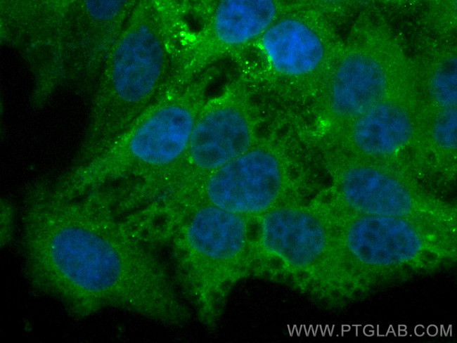 SEC61B Antibody in Immunocytochemistry (ICC/IF)