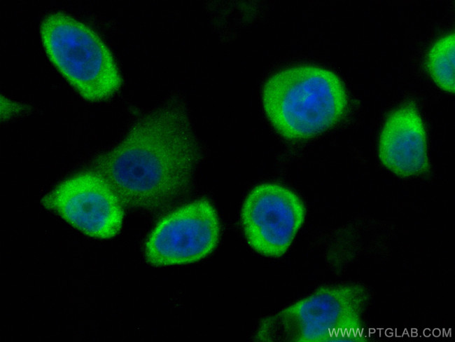 GSTO1 Antibody in Immunocytochemistry (ICC/IF)