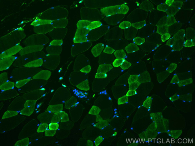 CA3 Antibody in Immunohistochemistry (PFA fixed) (IHC (PFA))