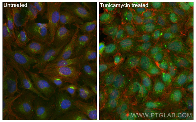 CHOP/GADD153 Antibody in Immunocytochemistry (ICC/IF)