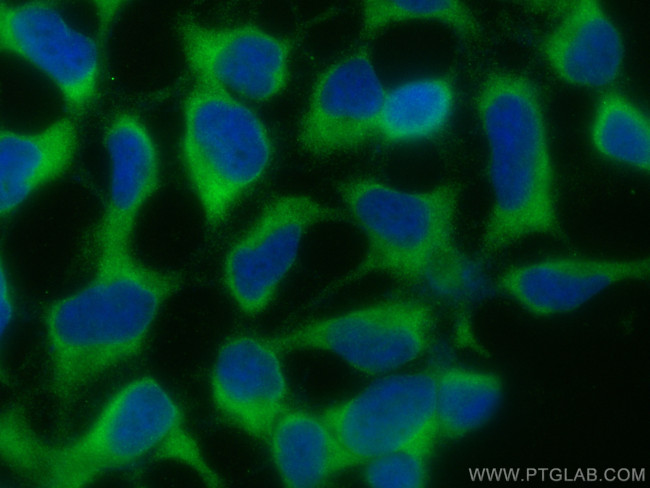CRACR2A Antibody in Immunocytochemistry (ICC/IF)