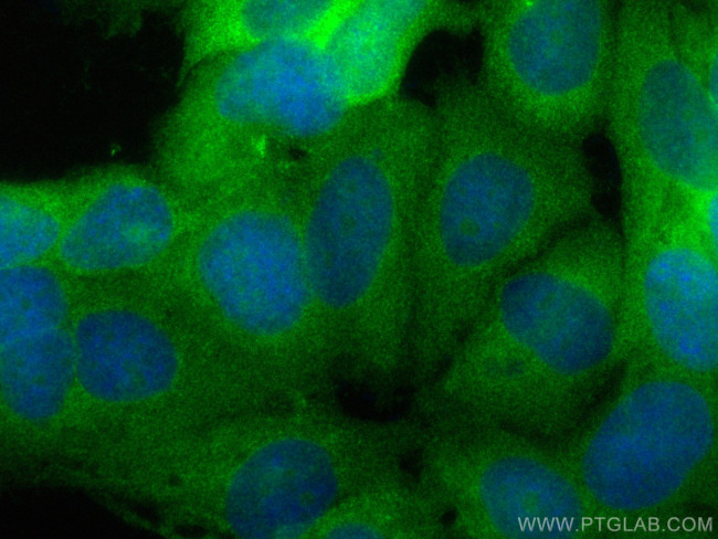 MAGED2 Antibody in Immunocytochemistry (ICC/IF)