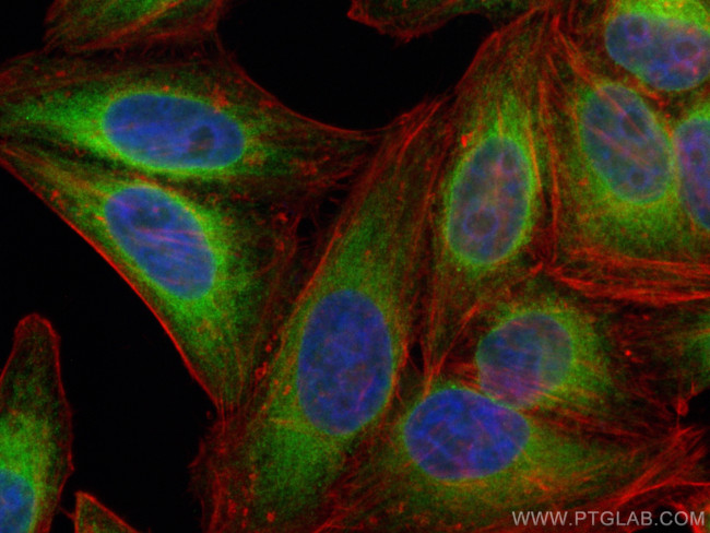 VAPA Antibody in Immunocytochemistry (ICC/IF)
