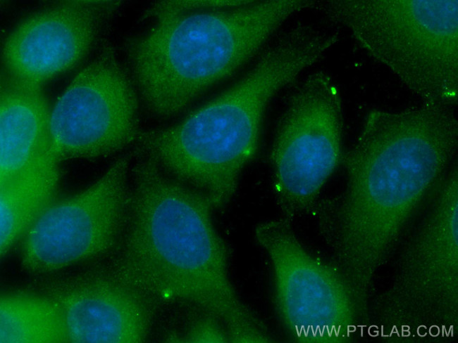 MYL9 Antibody in Immunocytochemistry (ICC/IF)