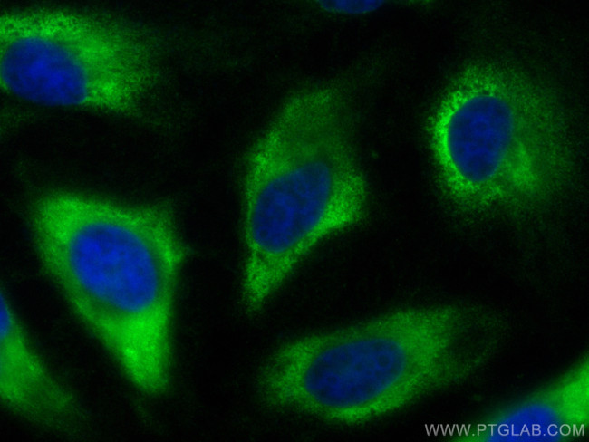 RPS27 Antibody in Immunocytochemistry (ICC/IF)