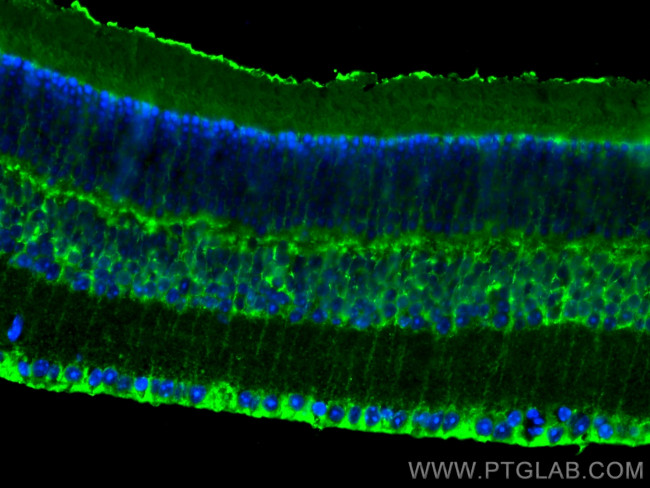 RLBP1 Antibody in Immunohistochemistry (PFA fixed) (IHC (PFA))