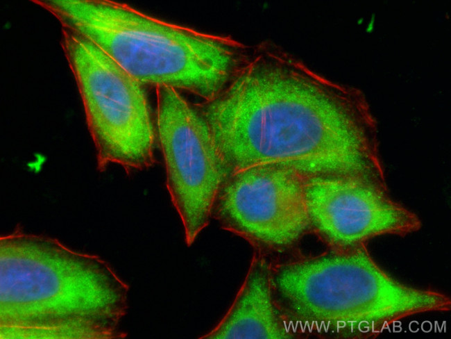 OSBPL10 Antibody in Immunocytochemistry (ICC/IF)