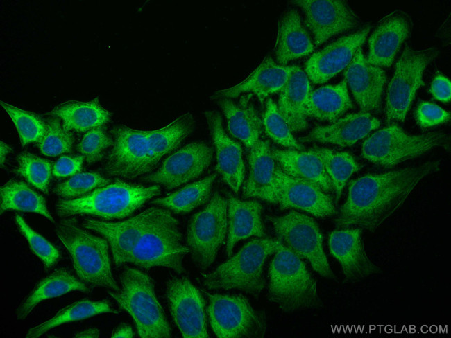Transgelin-2 Antibody in Immunocytochemistry (ICC/IF)