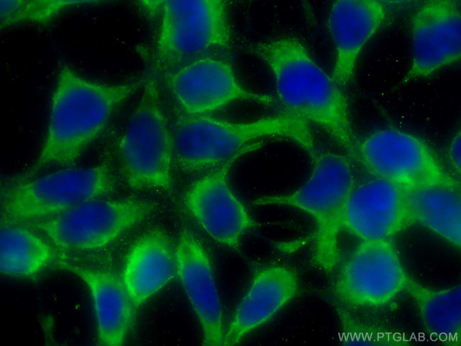 ALDH3A1 Antibody in Immunocytochemistry (ICC/IF)