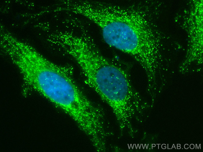 HSDL2 Antibody in Immunocytochemistry (ICC/IF)