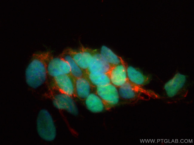 Islet 1 Antibody in Immunocytochemistry (ICC/IF)