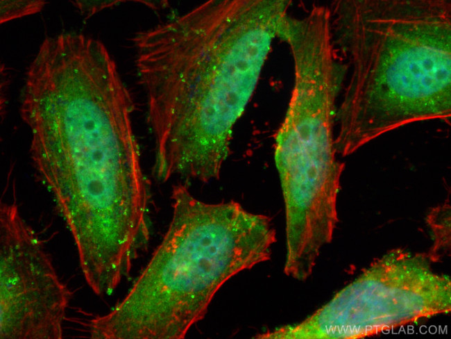 TRBP Antibody in Immunocytochemistry (ICC/IF)