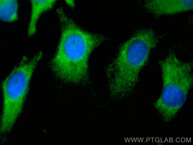 NQO2 Antibody in Immunocytochemistry (ICC/IF)