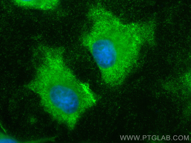TBCB Antibody in Immunocytochemistry (ICC/IF)