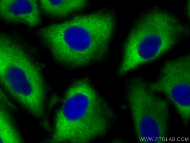 ALDH1A1 Antibody in Immunocytochemistry (ICC/IF)