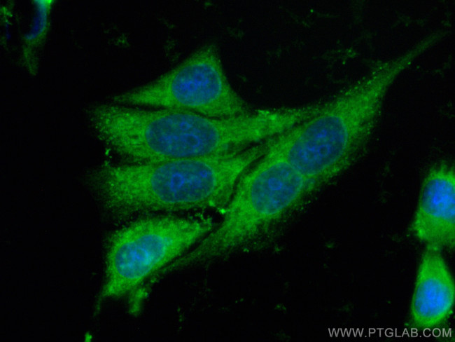 CNOT10 Antibody in Immunocytochemistry (ICC/IF)