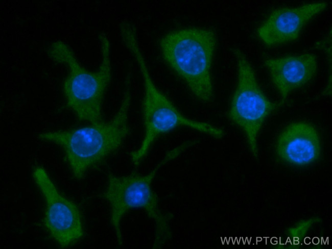 TIPE2 Antibody in Immunocytochemistry (ICC/IF)