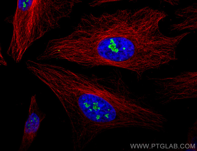 FBL Antibody in Immunocytochemistry (ICC/IF)