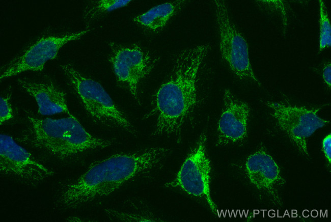 LETM1 Antibody in Immunocytochemistry (ICC/IF)