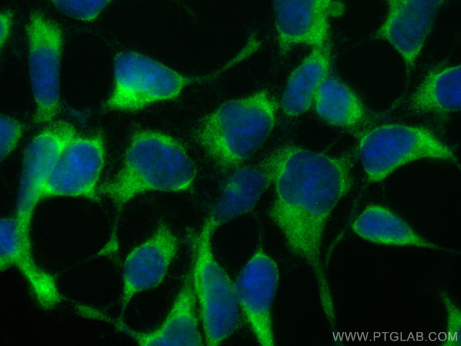 ATP6V1G1 Antibody in Immunocytochemistry (ICC/IF)
