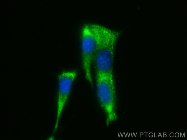Osteocalcin Antibody in Immunocytochemistry (ICC/IF)