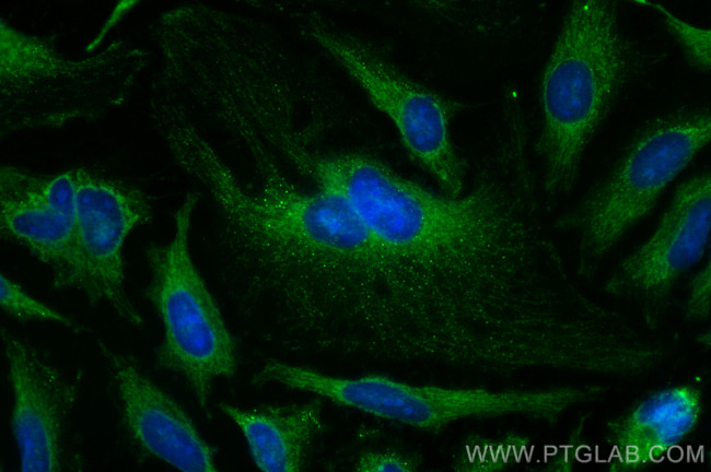 ACAT1 Antibody in Immunocytochemistry (ICC/IF)