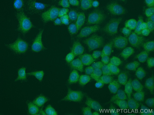 CEP70 Antibody in Immunocytochemistry (ICC/IF)