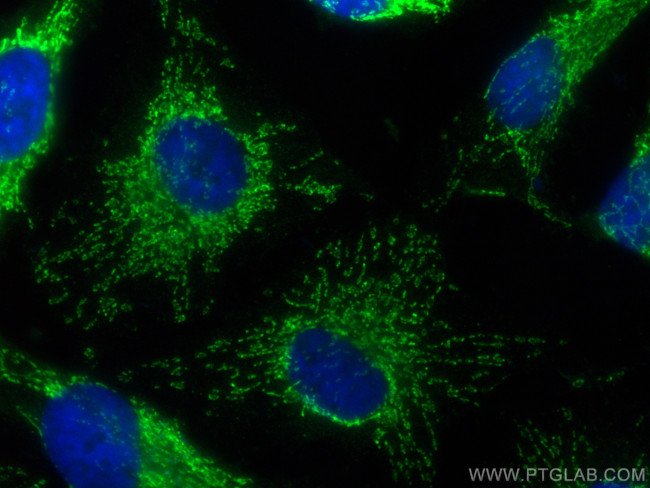 MRPS31 Antibody in Immunocytochemistry (ICC/IF)
