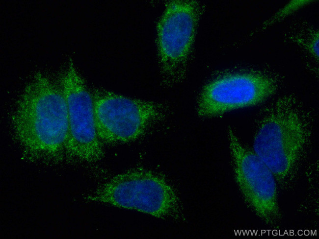 DLD Antibody in Immunocytochemistry (ICC/IF)