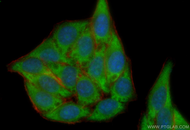 ORM1 Antibody in Immunocytochemistry (ICC/IF)
