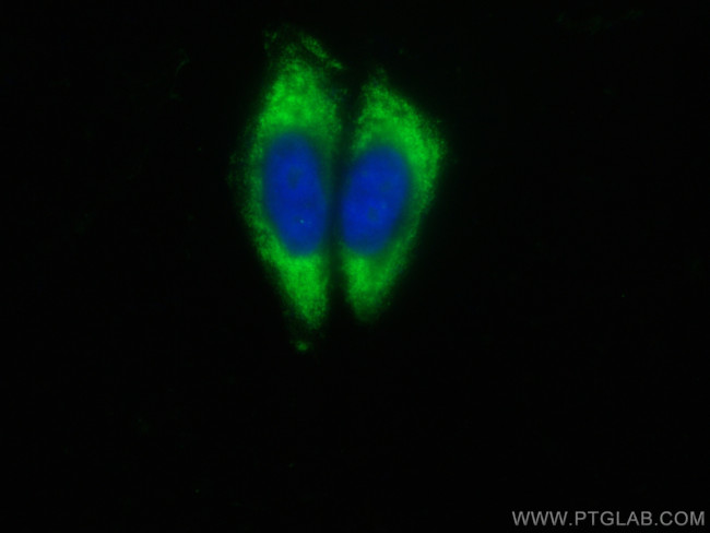 SRI Antibody in Immunocytochemistry (ICC/IF)