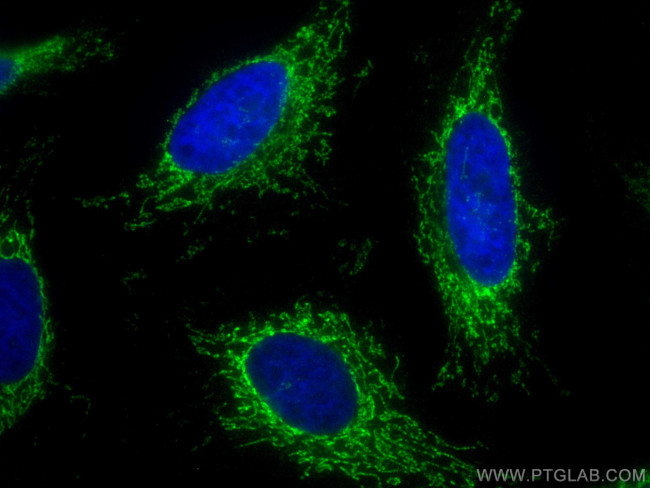 ATP5I Antibody in Immunocytochemistry (ICC/IF)