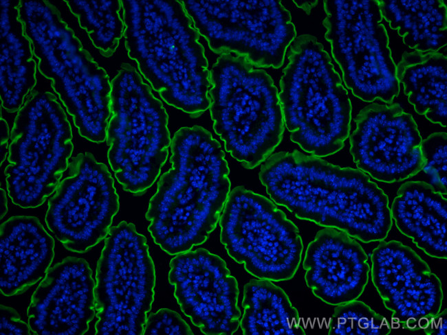 Villin Antibody in Immunohistochemistry (PFA fixed) (IHC (PFA))