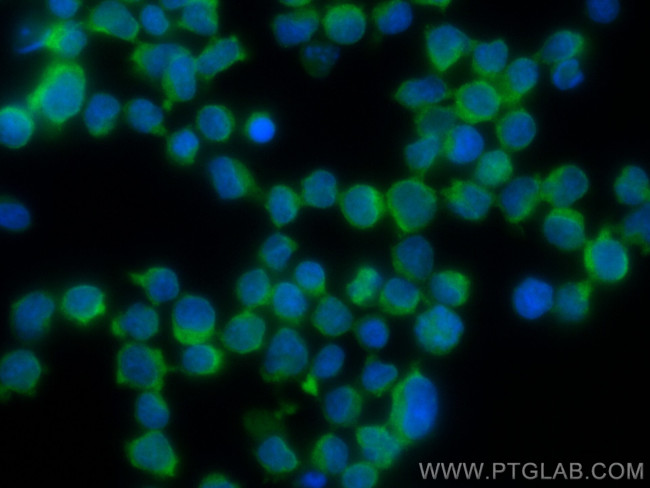 ARHGAP4 Antibody in Immunocytochemistry (ICC/IF)