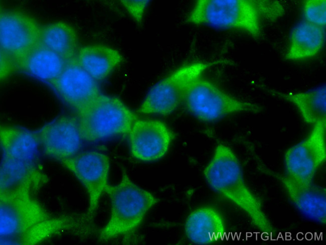 ARPC5 Antibody in Immunocytochemistry (ICC/IF)