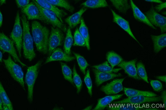 METTL5 Antibody in Immunocytochemistry (ICC/IF)