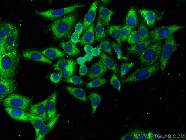 Apolipoprotein A II Antibody in Immunocytochemistry (ICC/IF)