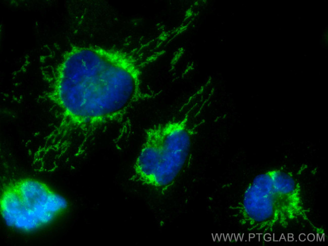 MTCH2 Antibody in Immunocytochemistry (ICC/IF)