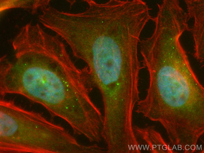 RECQL4 Antibody in Immunocytochemistry (ICC/IF)