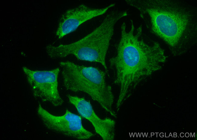 LATS1 Antibody in Immunocytochemistry (ICC/IF)