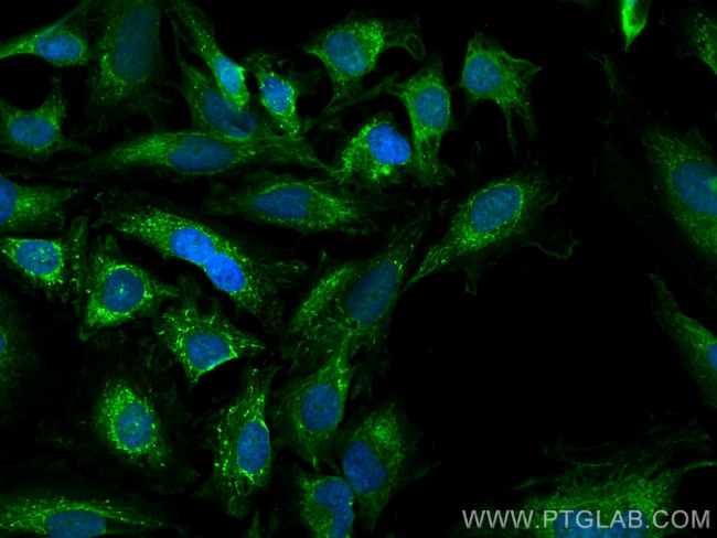PYCR2 Antibody in Immunocytochemistry (ICC/IF)